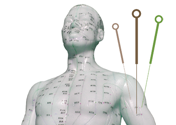 puntos y agujas de acupuntura