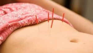 agujas de acupuntura en estomago para perder peso
